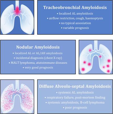 A unique case of AH-dominant type nodular pulmonary amyloidosis presenting as a spontaneous pneumothorax: a case report and review of the literature